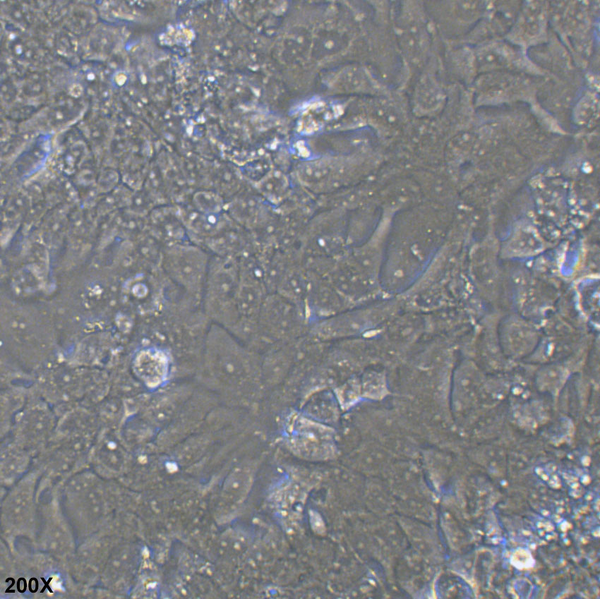 NCI-H2170 人肺鳞癌细胞
