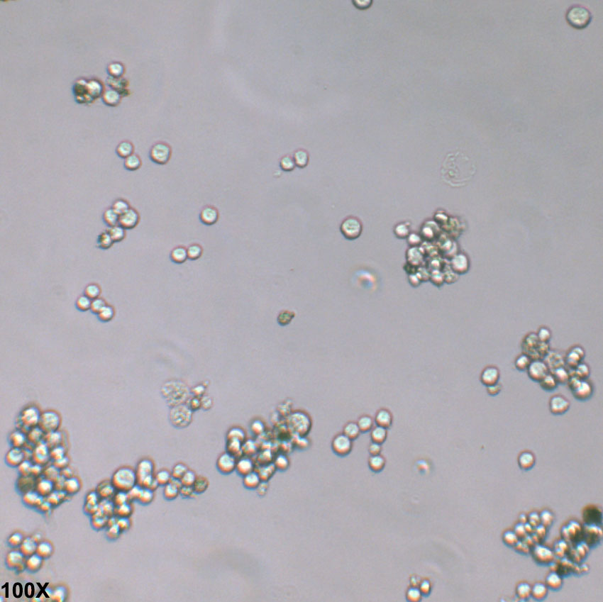 RPMI-8226 人多发性骨髓瘤外周血B淋巴细胞