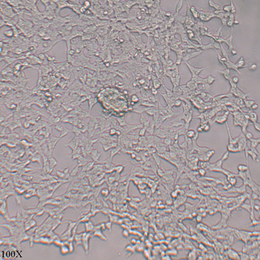 IMR-32 人神经母细胞瘤细胞