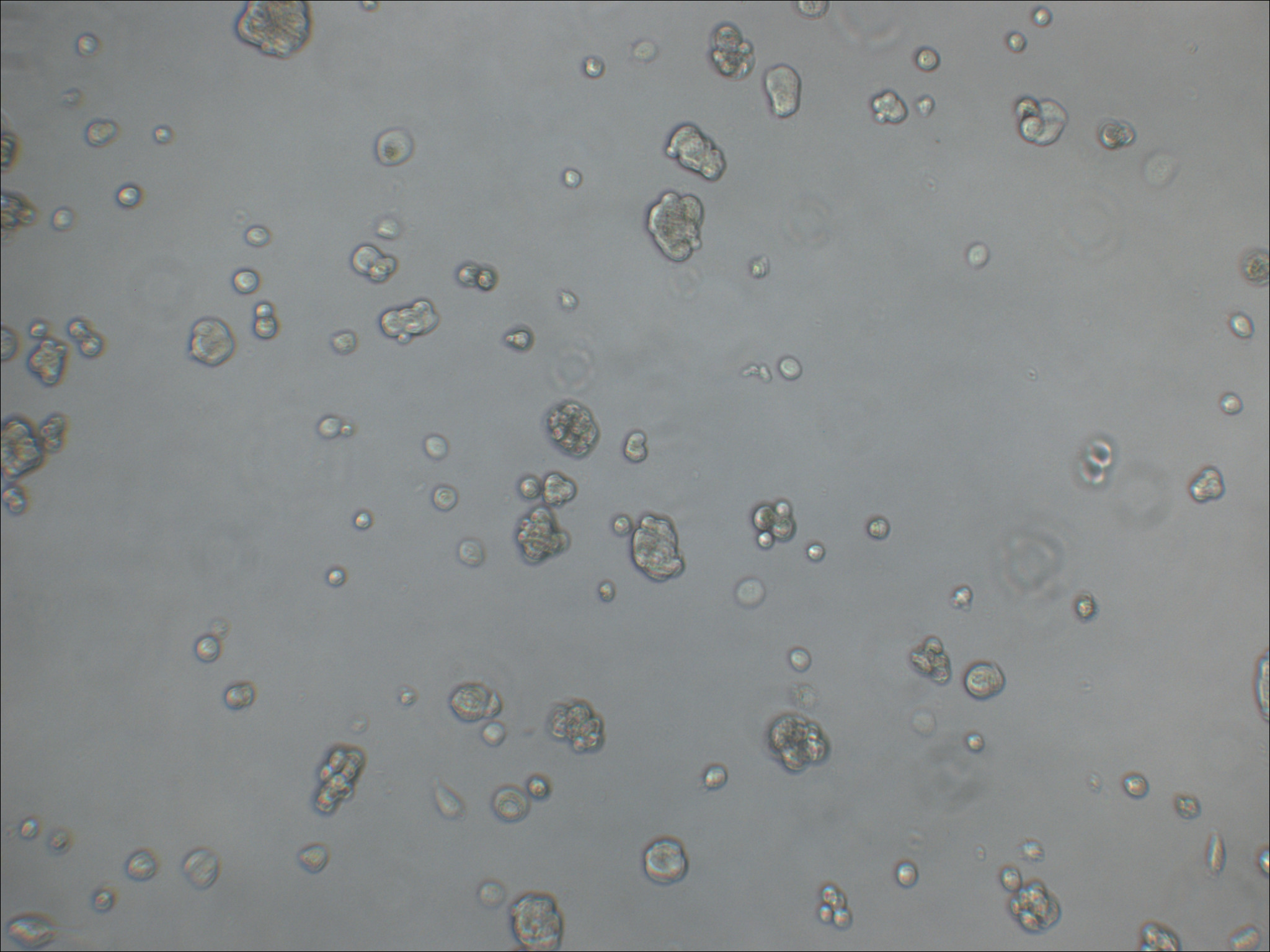 UACC812 人乳腺原导管瘤细胞