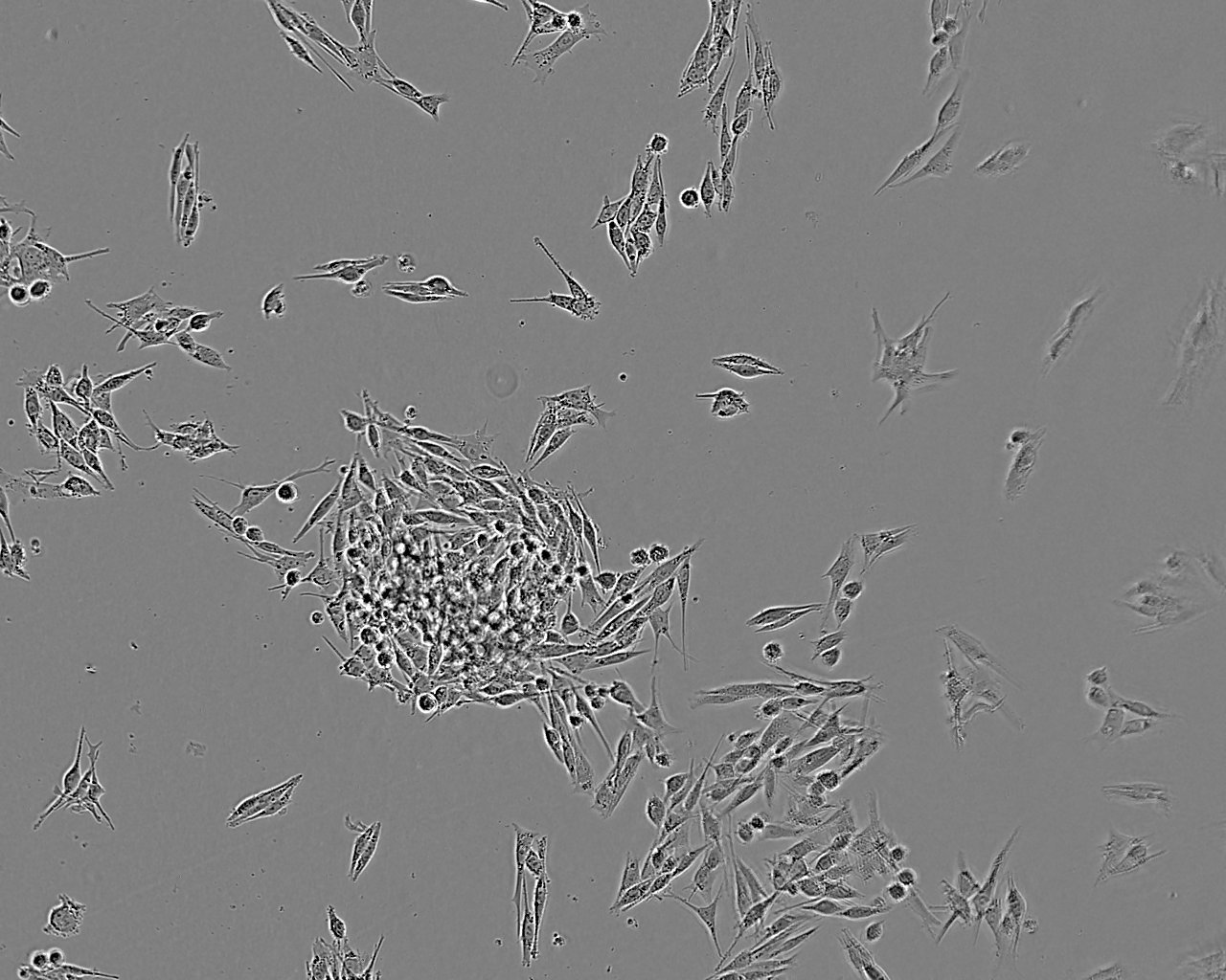 Mel202 人脉络膜黑色素瘤细胞