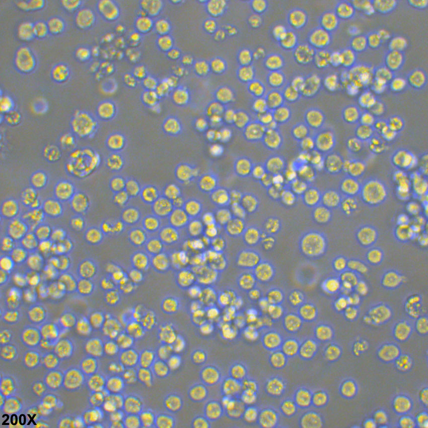Daudi 人Burkkit淋巴瘤细胞