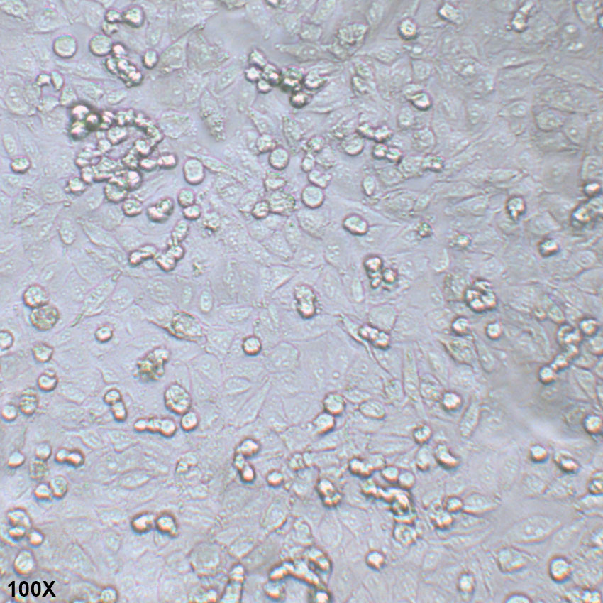 A-375 人恶性黑色素瘤细胞