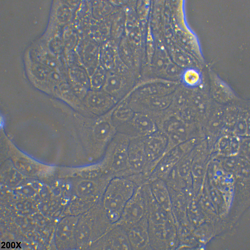 Calu-3 人肺腺癌细胞