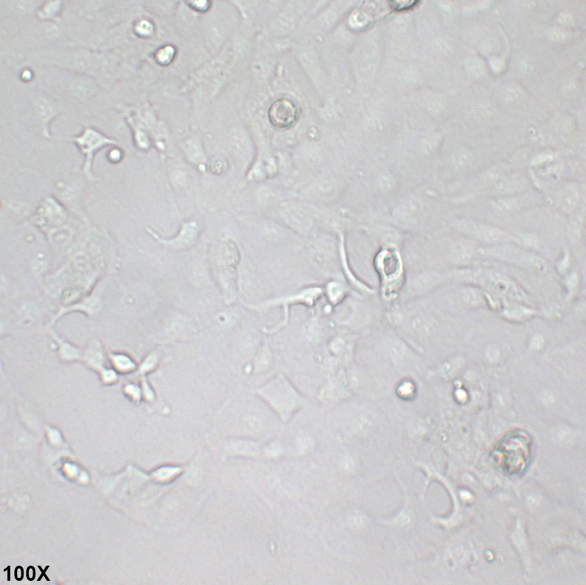 SW626 人结肠腺癌细胞(卵巢转移)