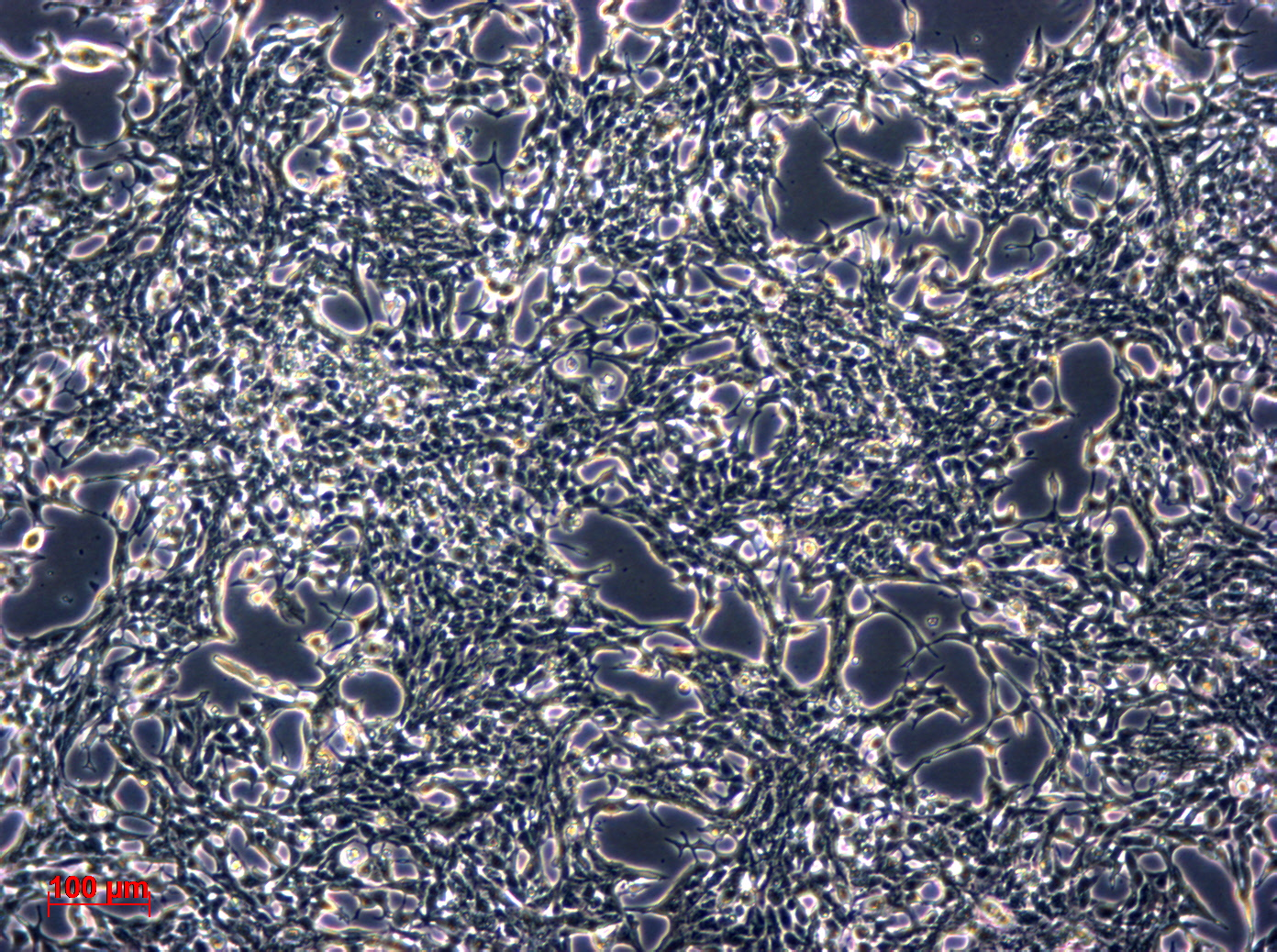 TT 人甲状腺导管癌细胞（髓样癌）