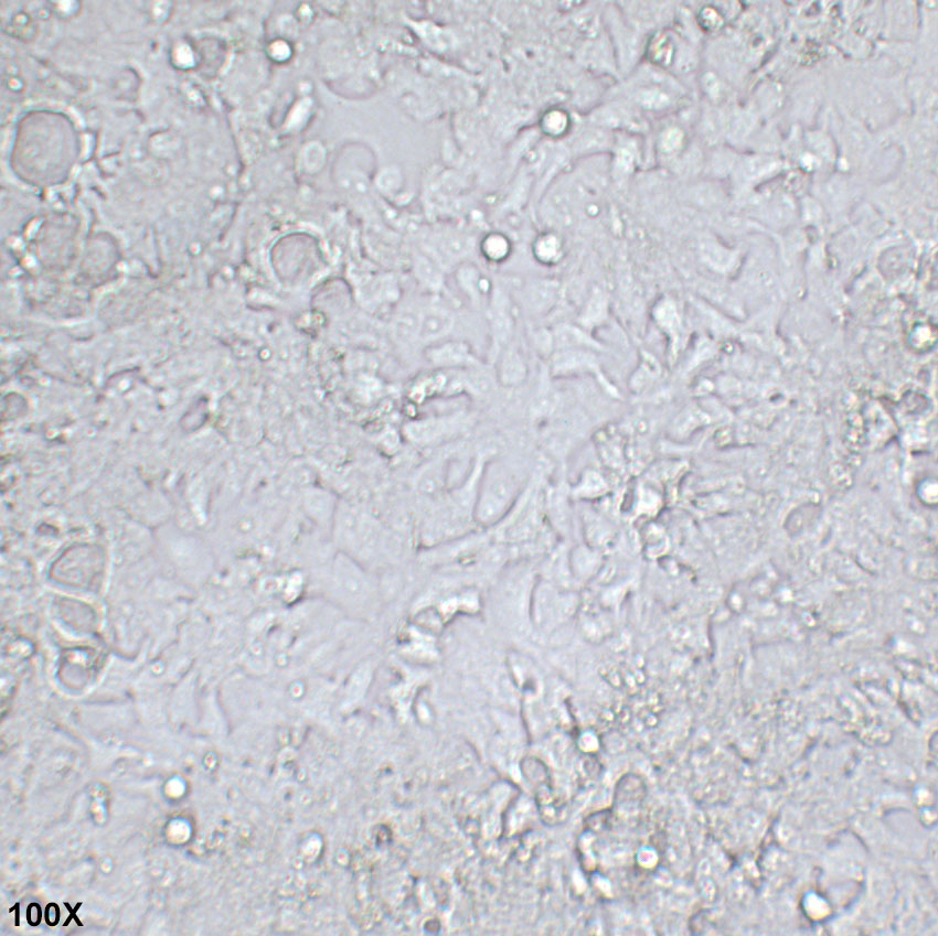 NCI-H2170 人肺鳞癌细胞