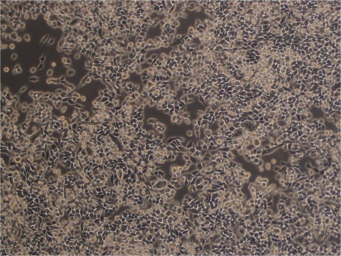 RKO 人结肠癌细胞