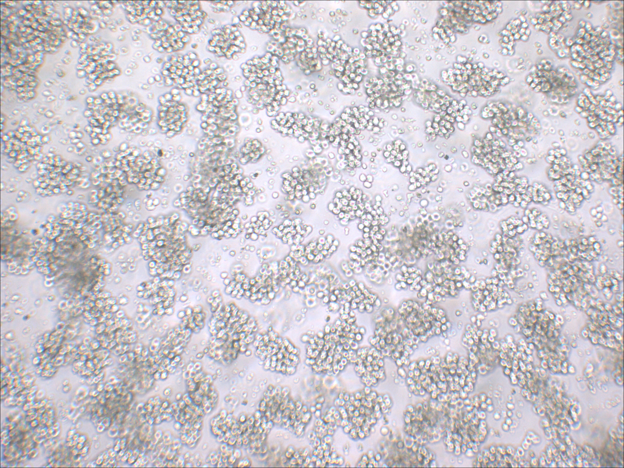 NB-4 人急性早幼粒白血病细胞