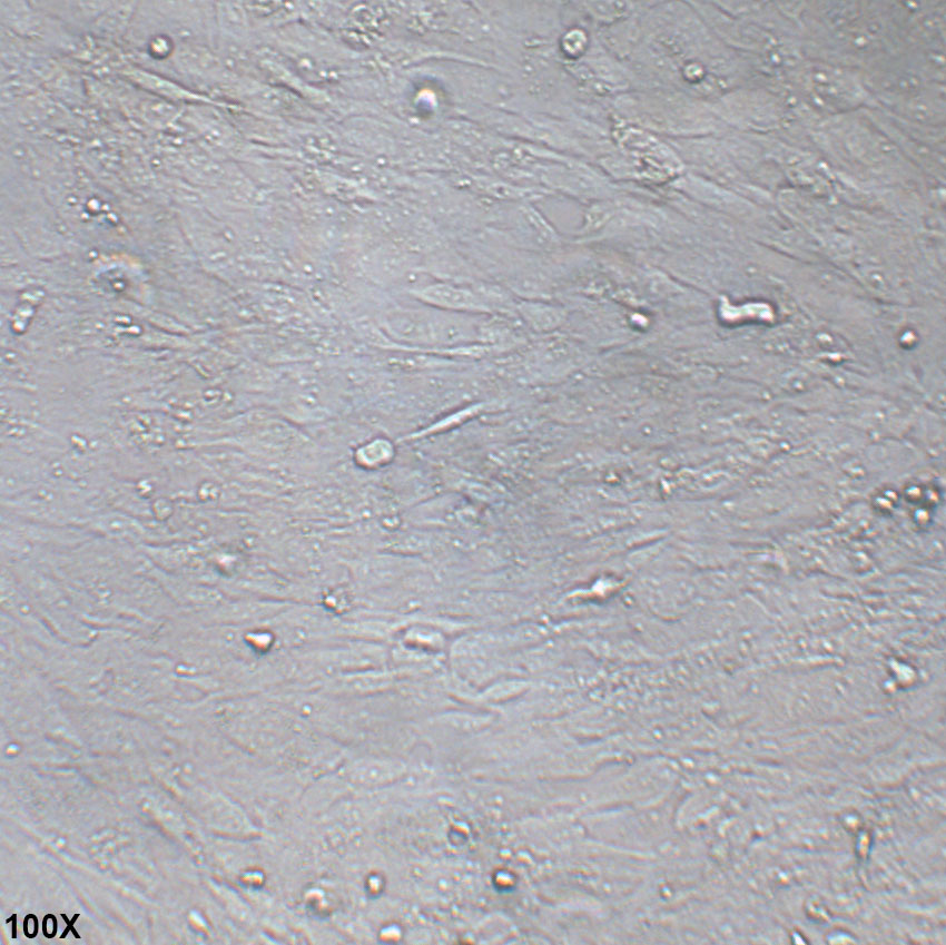 hFOB 1.19 SV40转染人成骨细胞