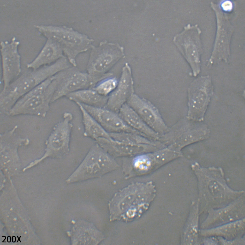 SAOS-2 人成骨肉瘤细胞