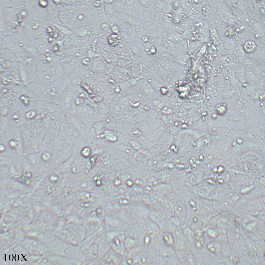 786-0 人肾透明细胞腺癌细胞