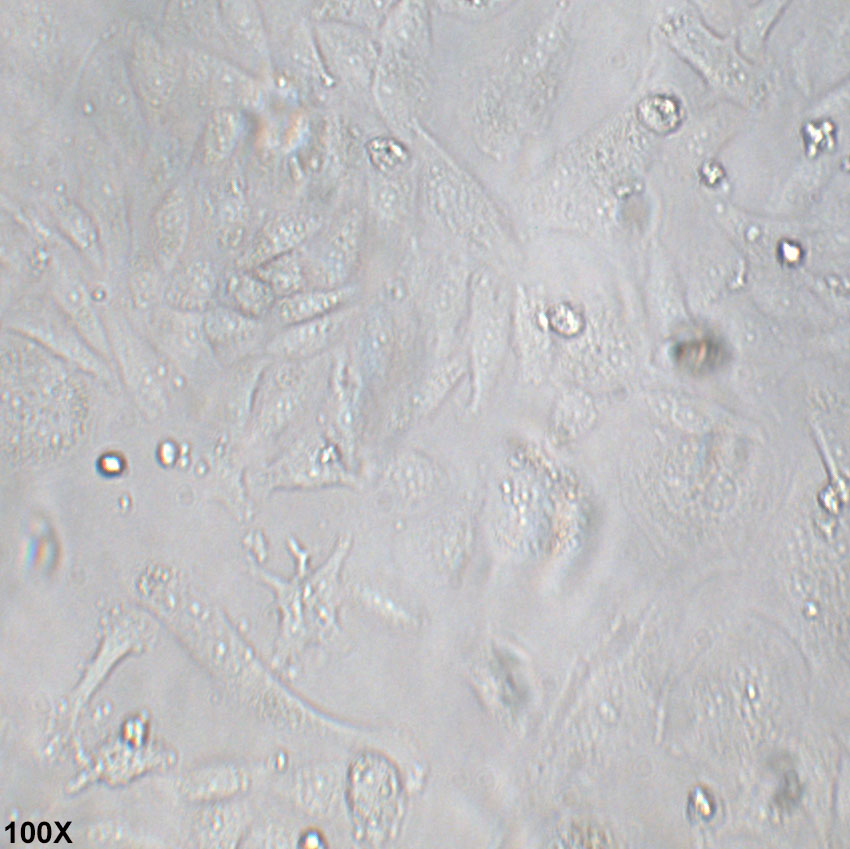 SK-Lu-1 人低分化肺腺癌细胞