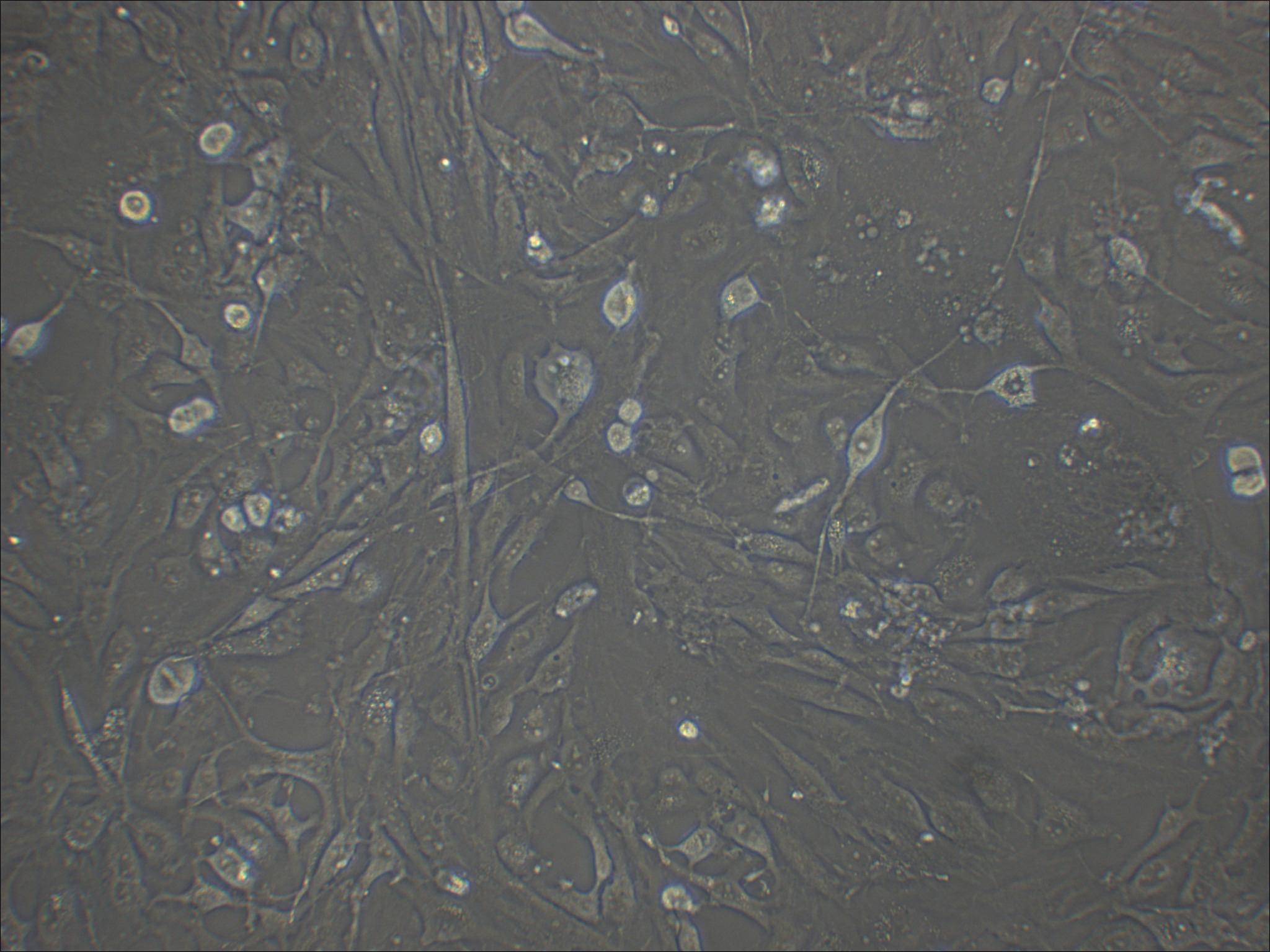 8305C 人甲状腺癌细胞（退行性）