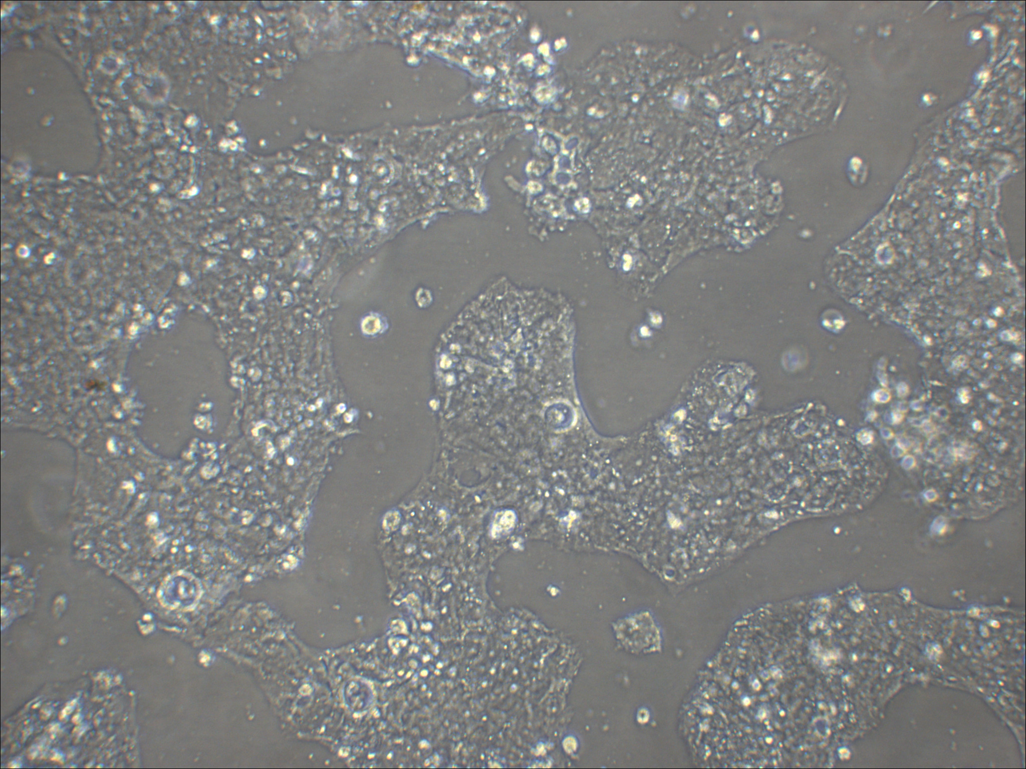 Caco-2 人结直肠腺癌细胞