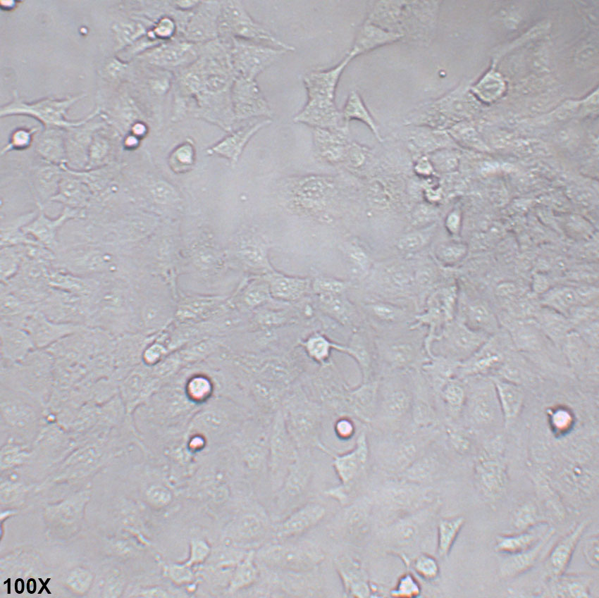 DU145 人前列腺癌细胞