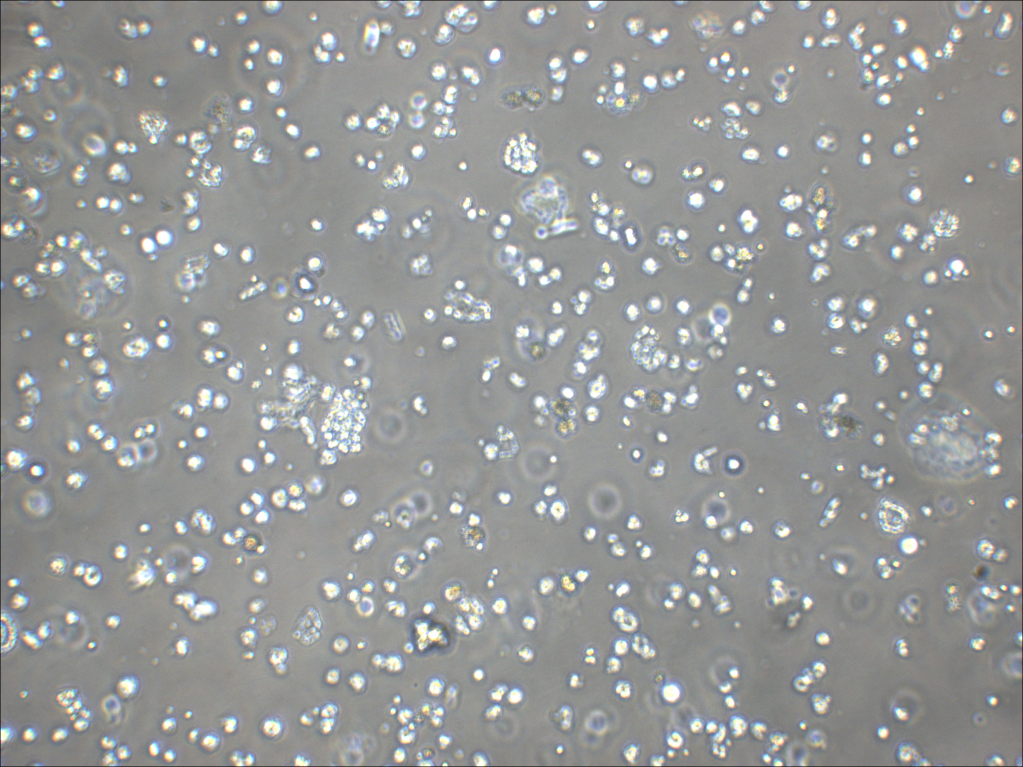 NK92 人自然杀伤细胞淋巴瘤细胞