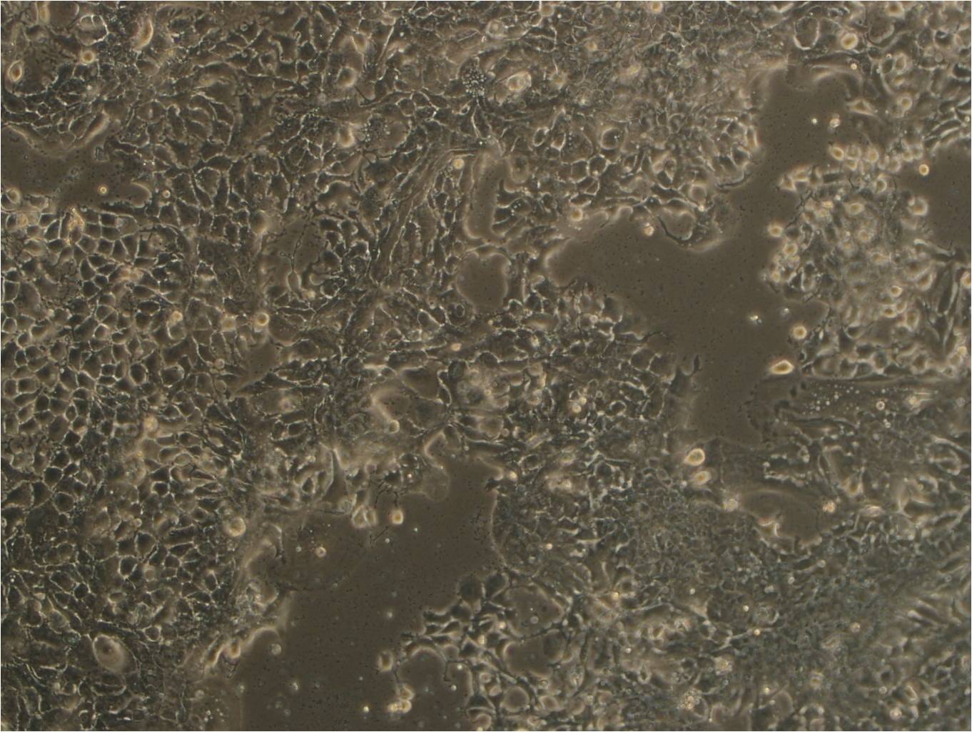 MDA-MB-415 人乳腺腺癌细胞