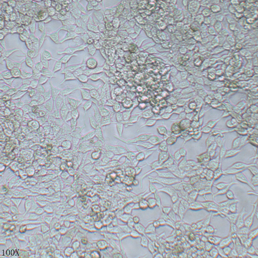 LNCaP 人前列腺癌细胞