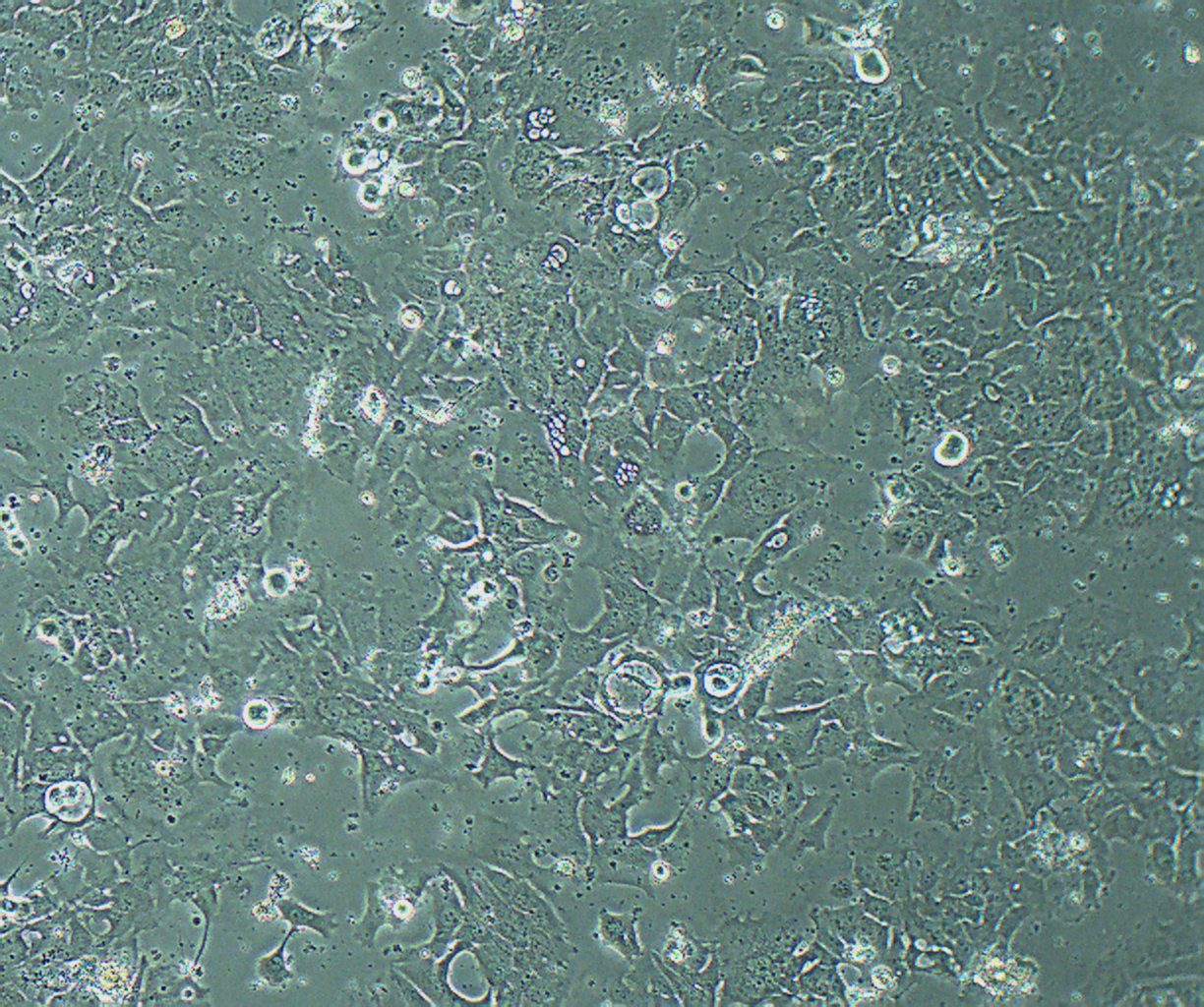HCC1954 人乳腺导管癌细胞