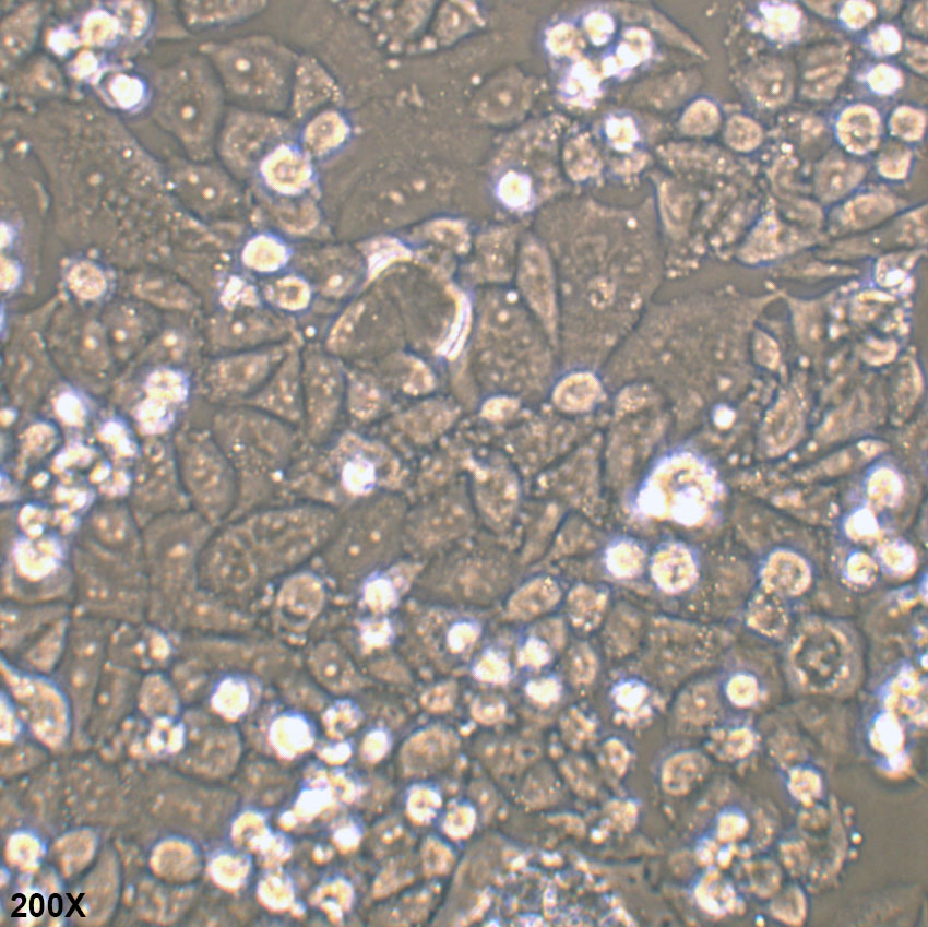 C-33A 人宫颈癌细胞