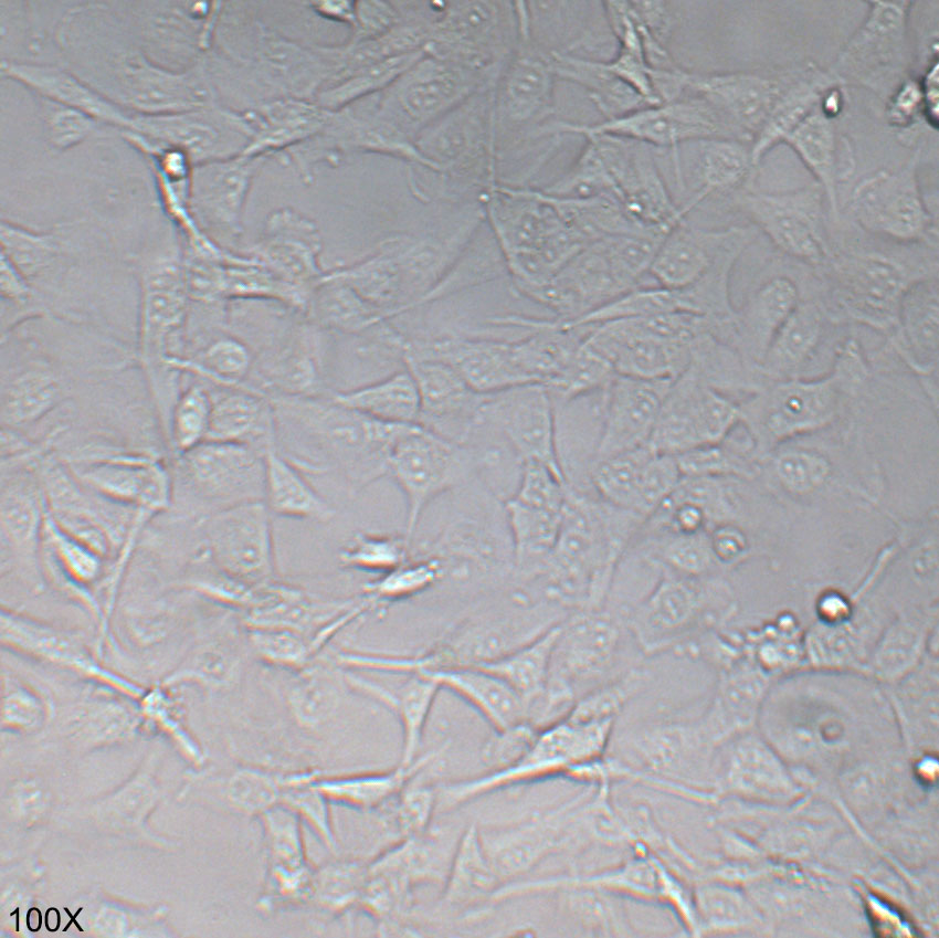 KHM-5M 人甲状腺癌细胞（退行性）