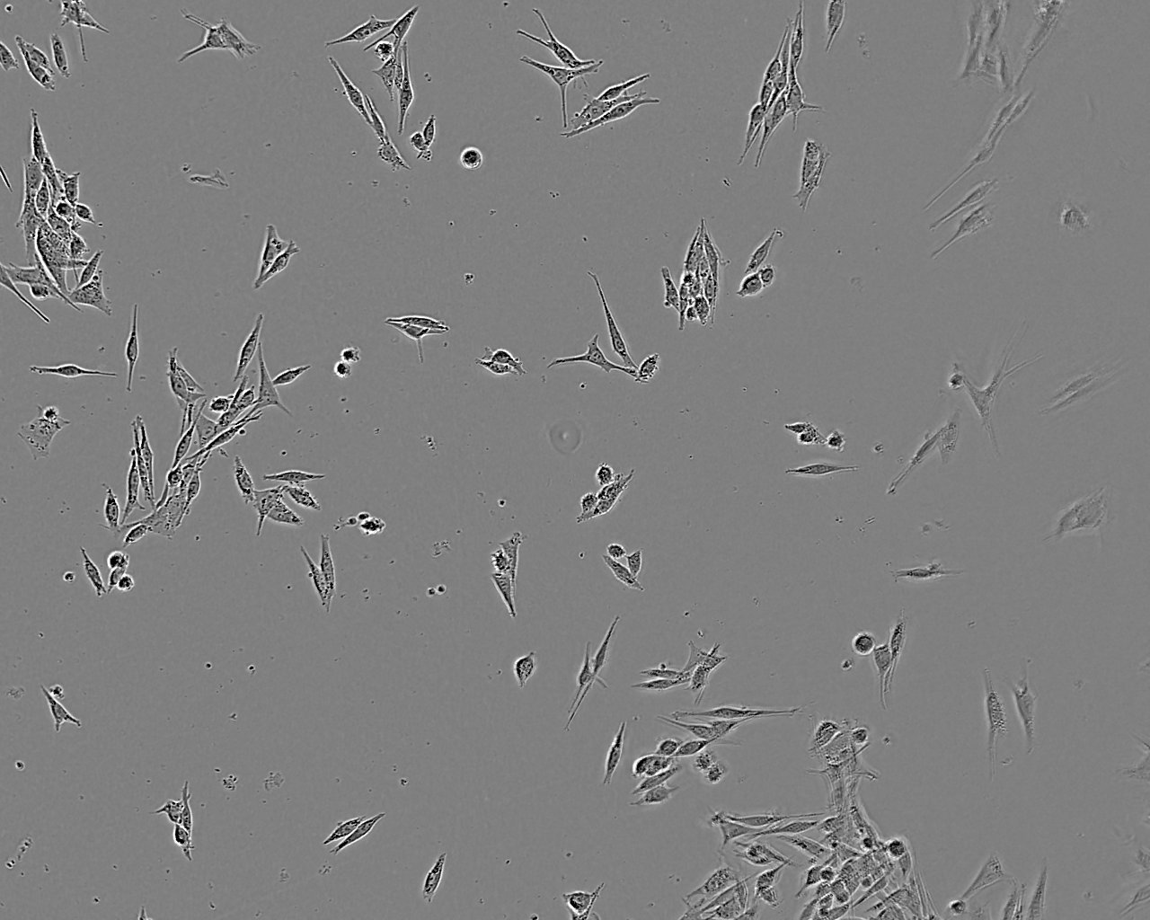 Mel202 人脉络膜黑色素瘤细胞