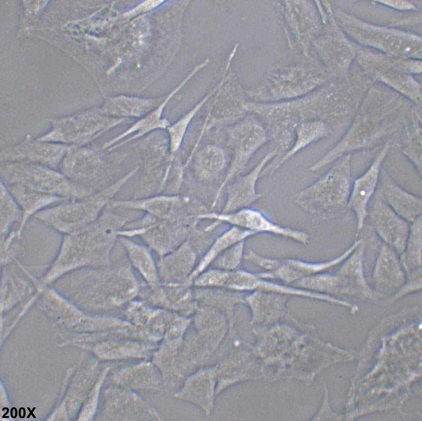 CCF-STTG1 人脑星形胶质细胞瘤细胞