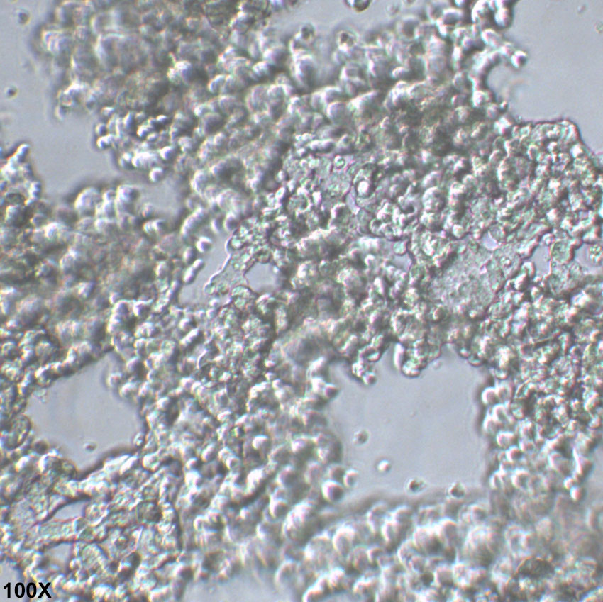 NCI-H524 人小细胞肺癌细胞
